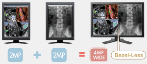 advantages of a 4mp bezel-less monitor