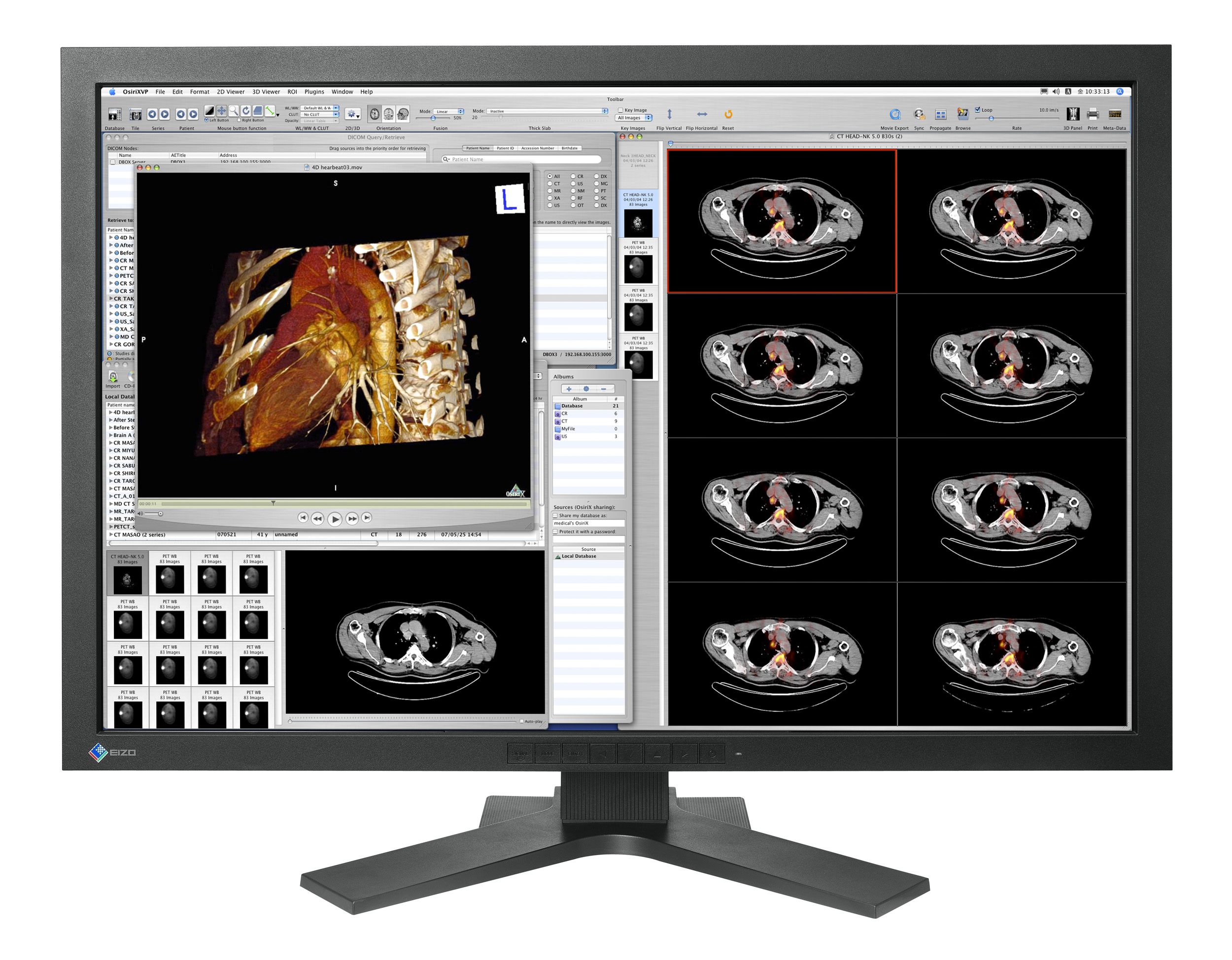 eizo mx300w monitor MX300W front view