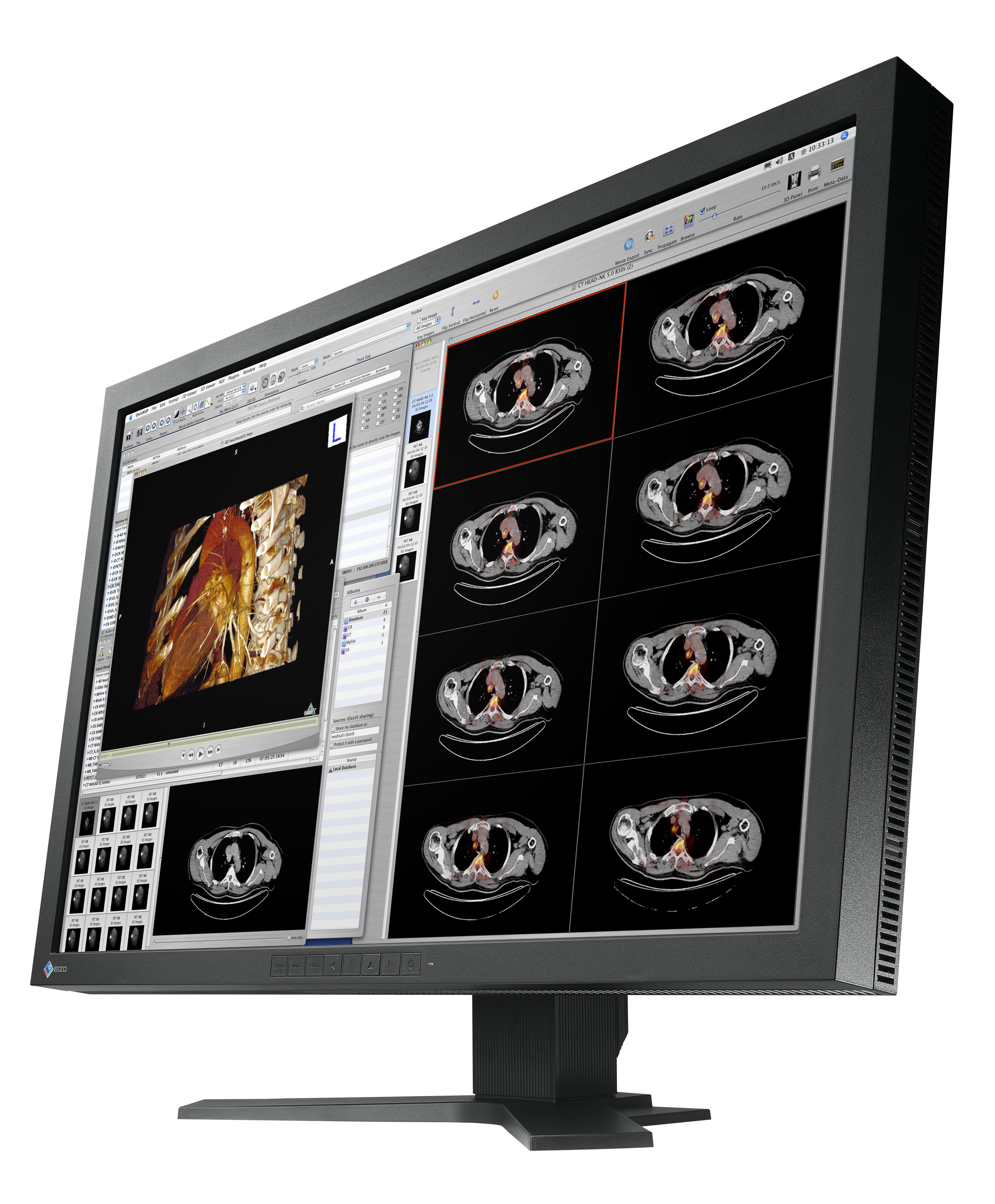 eizo medical monitor MX300W side view